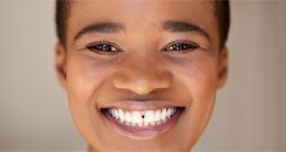 Smiling woman with gap between her front teeth
