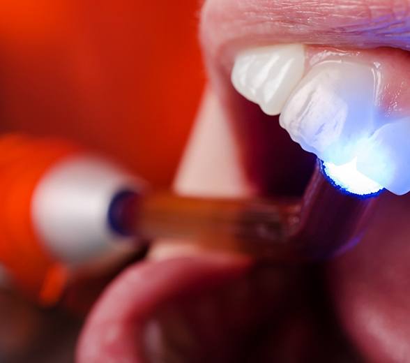 Dental light hardening resin material