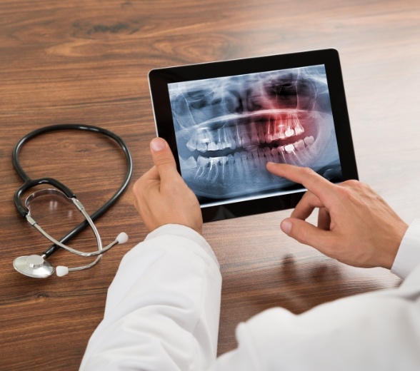 Dentist examining an x ray showing teeth with some highlighted red
