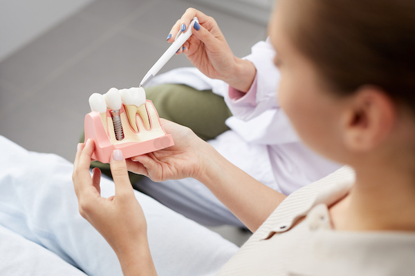 woman looking at dental implant model alongside dentist