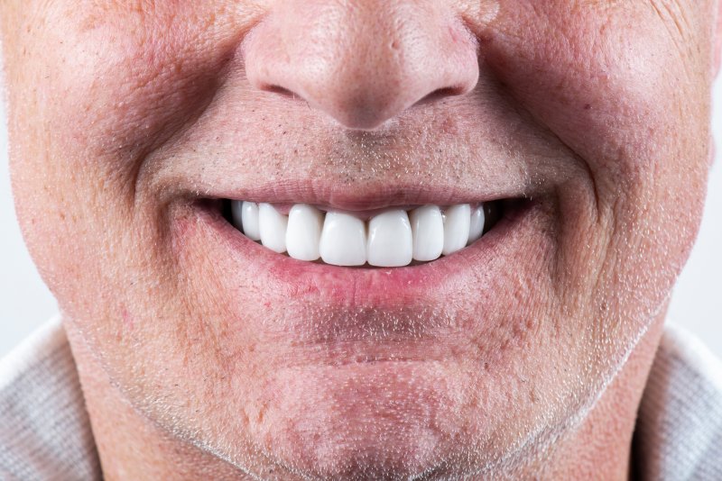 man smiling with the benefits of porcelain veneers in Greenville