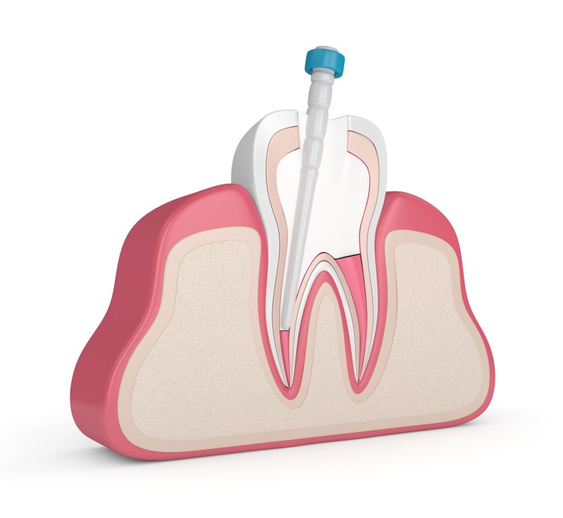 3D render of a root canal